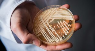 Drug-Resistant Fungal Infections Are on the Rise in the U.S.